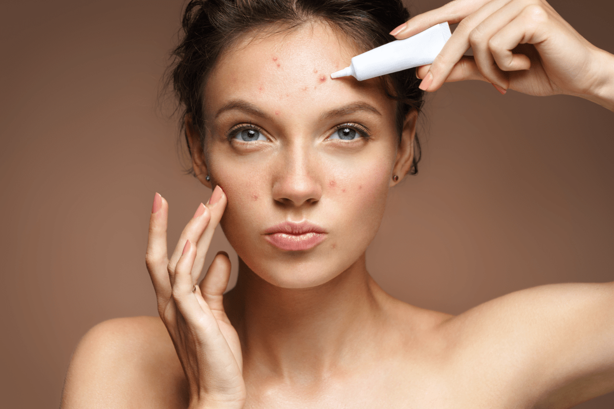 Top 3 Acne Myths Debunked by a Dermatologist