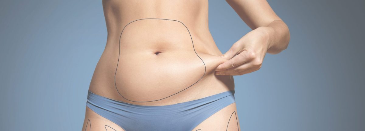 What is CoolSculpting & How Does It Work?