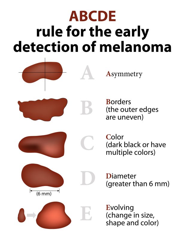 What is Immunotherapy?