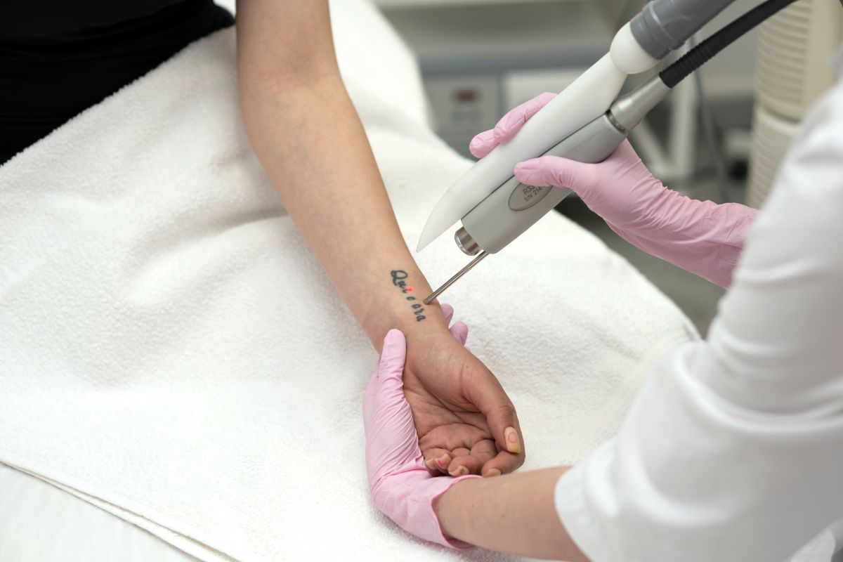 Tattoo Removal Recovery and Aftercare